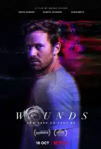 Armie Hammer